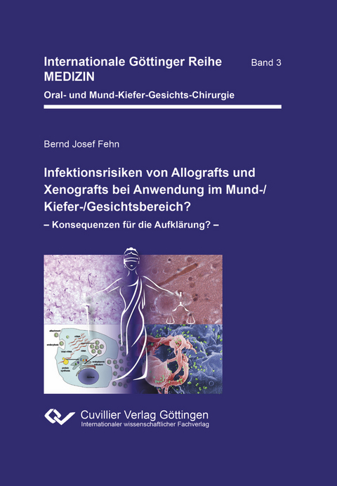 Infektionsrisiken von Allografts und Xenografts bei Anwendung im Mund-/Kiefer-/Gesichtsbereich? -  Bernd Josef Fehn