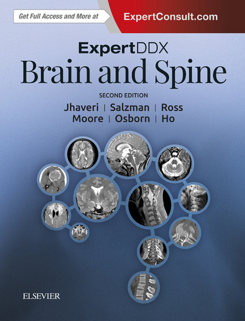 ExpertDDx: Brain and Spine -  Chang Yueh Ho,  Miral D. Jhaveri,  Anne G. Osborn,  Jeffrey S. Ross,  Karen L. Salzman