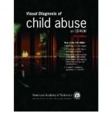 Visual Diagnosis of Child Abuse - Lowen, Deborah; Reece, Robert M.; AAP - American Academy of Pediatrics