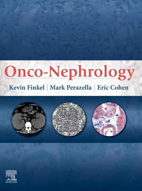 Onco-Nephrology -  Eric P Cohen,  Kevin W. Finkel,  Mark Anthony Perazella