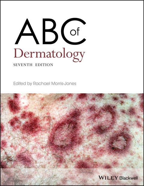 ABC of Dermatology - 