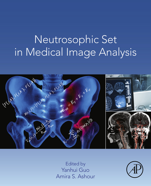 Neutrosophic Set in Medical Image Analysis - 
