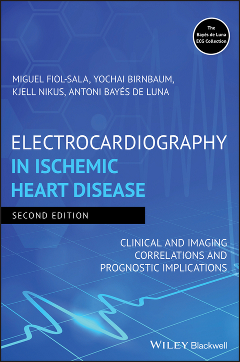 Electrocardiography in Ischemic Heart Disease -  Yochai Birnbaum,  Miquel Fiol-Sala,  Antoni Bay s de Luna,  Kjell Nikus