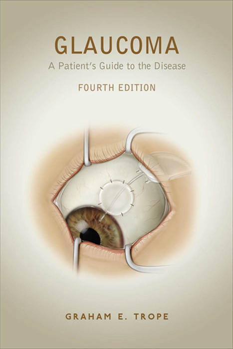 Glaucoma -  Graham E. Trope