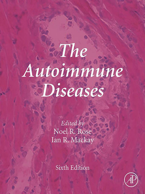 Autoimmune Diseases - 