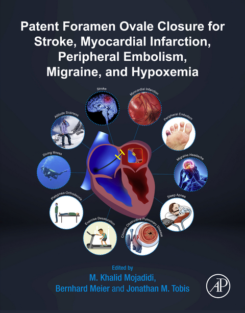 Patent Foramen Ovale Closure for Stroke, Myocardial Infarction, Peripheral Embolism, Migraine, and Hypoxemia - 