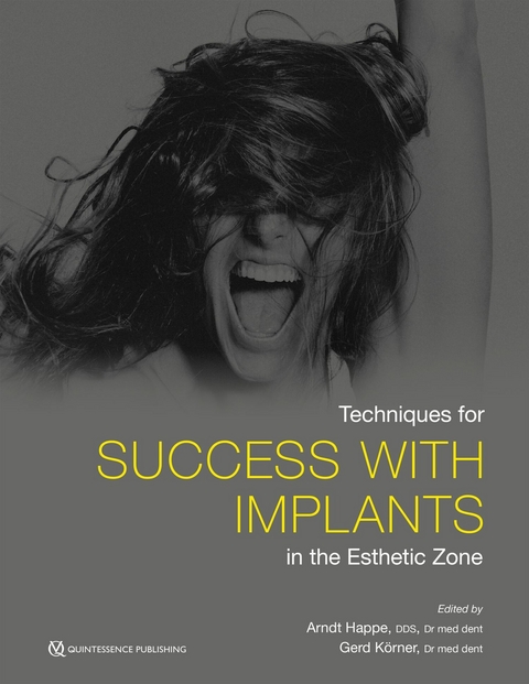 Techniques for Success With Implants in the Esthetic Zone - Arndt Happe, Gerd Körner