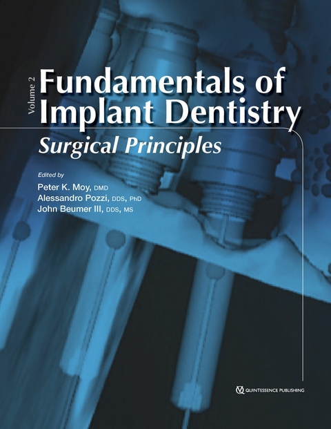Fundamentals of Implant Dentistry, Volume II - Peter K Moy, Alessandro Pozzi, John III Beumer