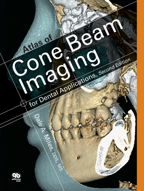 Atlas of Cone Beam Imaging for Dental Applications - Dale A. Miles