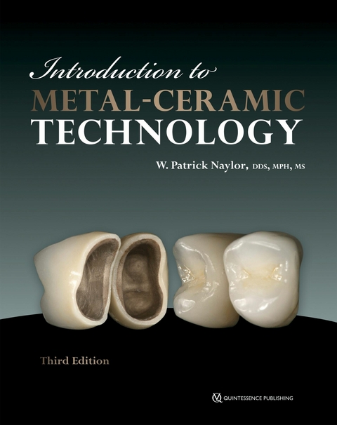 Introduction to Metal-Ceramic Technology -  W. Patrick Naylor