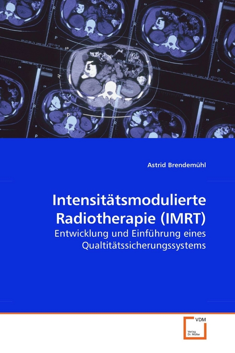 Intensitätsmodulierte Radiotherapie (IMRT) -  Astrid Brendemühl