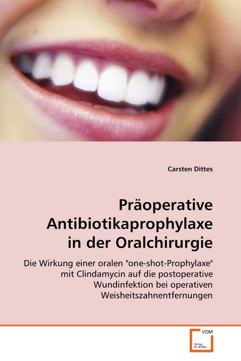 Präoperative Antibiotikaprophylaxe in derOralchirurgie -  Carsten Dittes