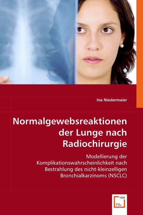 Normalgewebsreaktionen der Lunge nach Radiochirurgie -  Ina Niedermaier