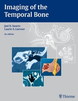 Imaging of the Temporal Bone - Swartz, Joel D.; Loevner, Laurie A.