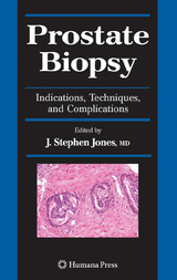 Prostate Biopsy - 