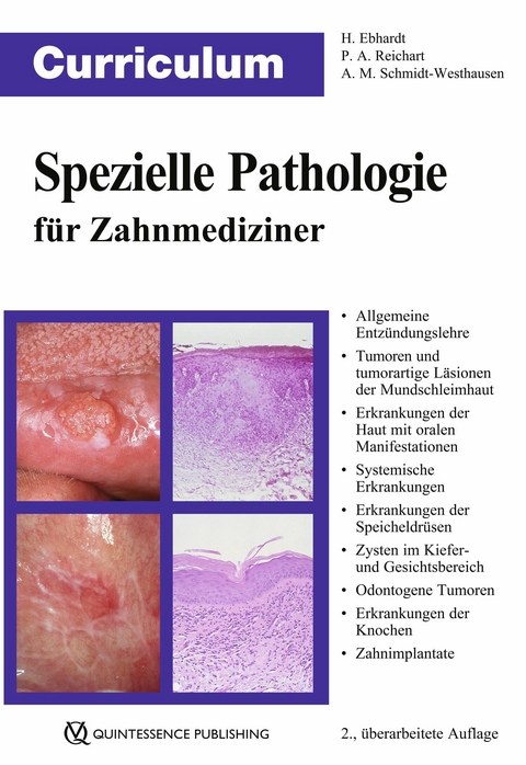 Curriculum Spezielle Pathologie für Zahnmediziner - Harald Ebhardt, Peter A. Reichart, Andrea Maria Schmidt-Westhausen