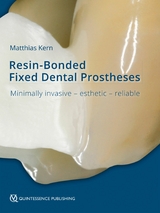 Resin-Bonded Fixed Dental Prostheses - Matthias Kern