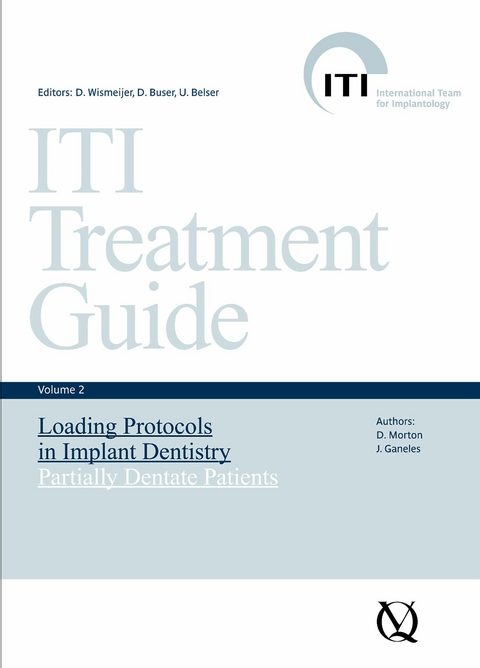 Loading Protocols in Implant Dentistry - 