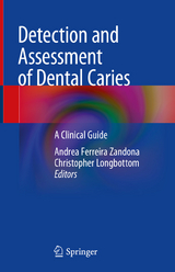Detection and Assessment of Dental Caries - 
