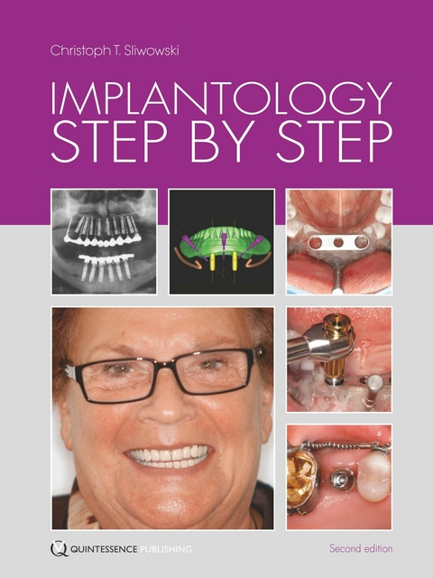 Implantology Step by Step - Christoph T. Sliwowski