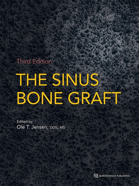 The Sinus Bone Graft - Ole T. Jensen