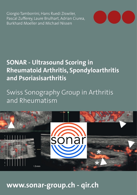 SONAR - Ultrasound Scoring in Rheumatoid Arthritis, Spondyloarthritis and Psoriasisarthritis -  Giorgio Tamborrini,  Hans Ruedi Ziswiler,  Pascal Zufferey,  Laure Brulhart,  Adrian Ciurea,  Burkhard Mo