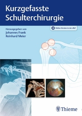 Kurzgefasste Schulterchirurgie - 