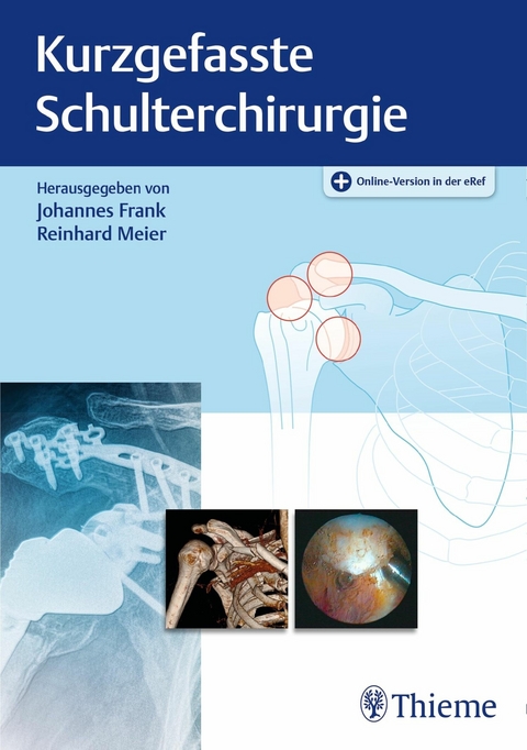 Kurzgefasste Schulterchirurgie - 