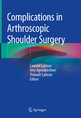 Complications in Arthroscopic Shoulder Surgery - 