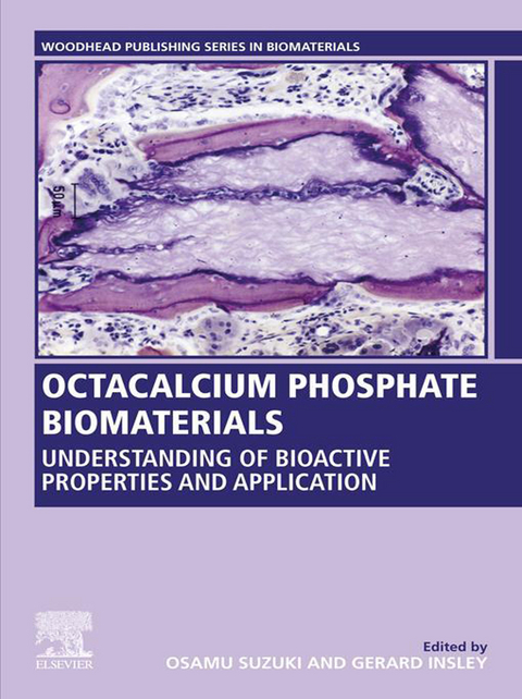 Octacalcium Phosphate Biomaterials - 