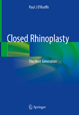 Closed Rhinoplasty -  Paul J O'Keeffe