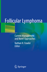 Follicular Lymphoma - 