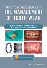 Practical Procedures in the Management of Tooth Wear -  Subir Banerji,  Bas Loomans,  Shamir B. Mehta,  Niek Opdam