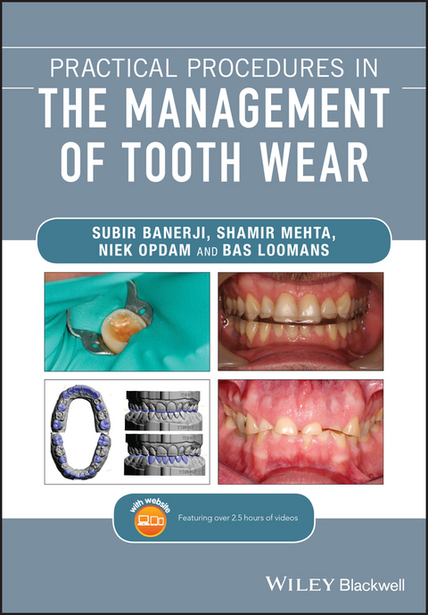 Practical Procedures in the Management of Tooth Wear - Subir Banerji, Shamir B. Mehta, Niek Opdam, Bas Loomans