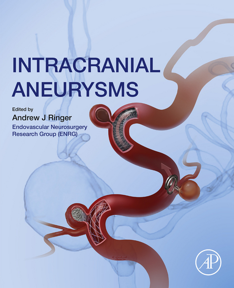 Intracranial Aneurysms - 