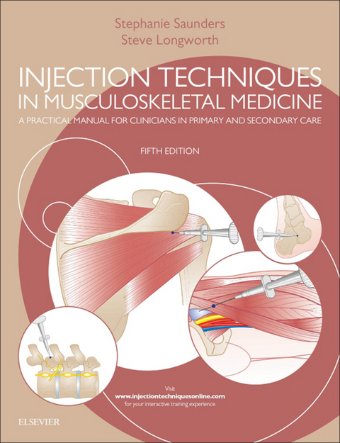 Injection Techniques in Musculoskeletal Medicine -  Steve Longworth,  Stephanie Saunders