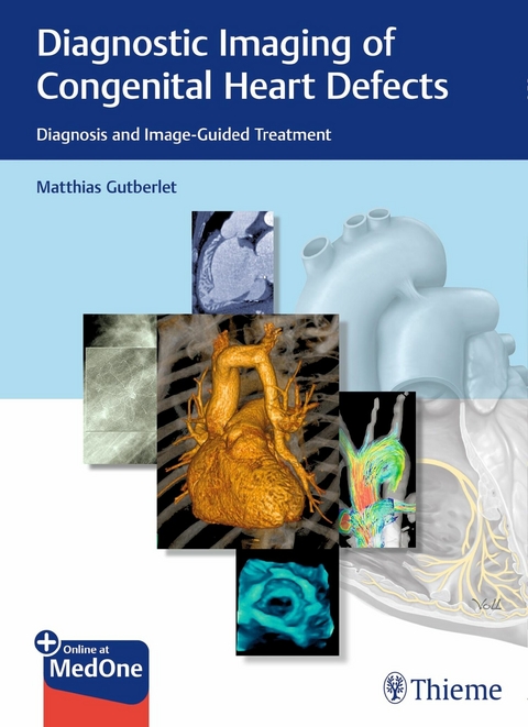 Diagnostic Imaging of Congenital Heart Defects - 