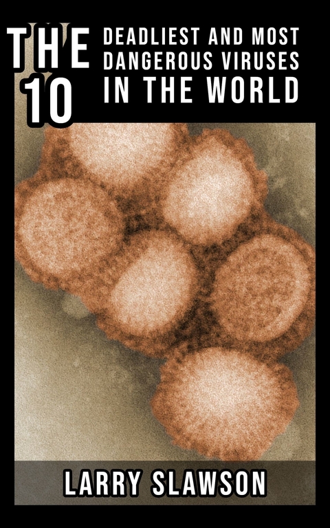 The 10 Deadliest and Most Dangerous Viruses in the World -  Larry Slawson
