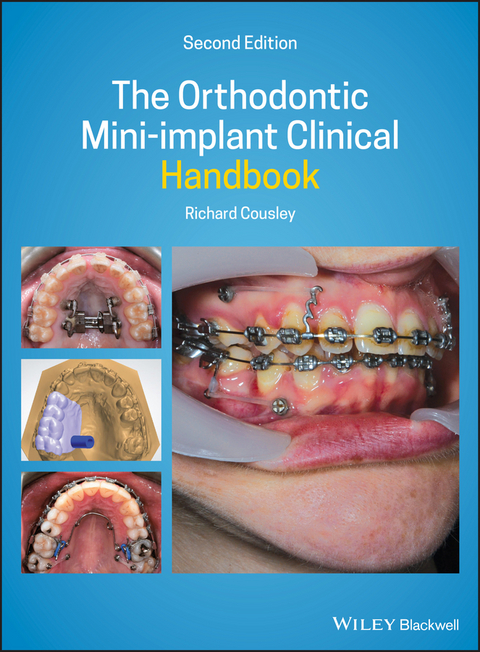 Orthodontic Mini-implant Clinical Handbook -  Richard Cousley