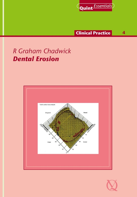 Dental Erosion - R. Graham Chadwick