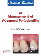 Clinical Success in Management of Advanced Periodontitis -  Roger Detienville