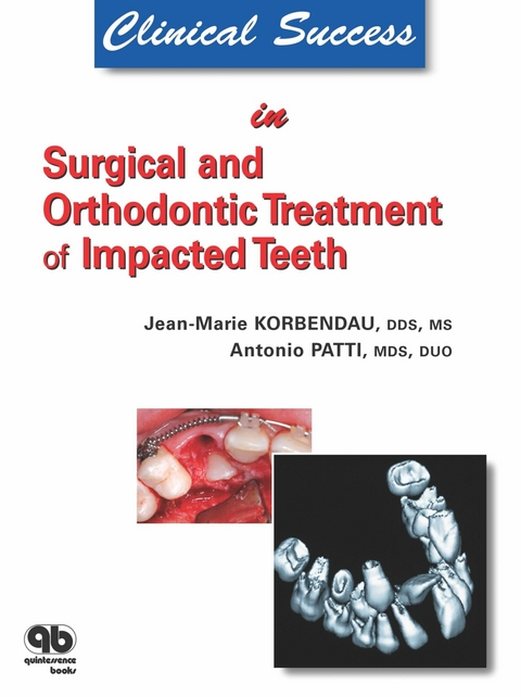 Clinical Success in Surgical and Orthodontic Treatment of Impacted Teeth -  Jean-Marie Korbendau,  Antonio Patti