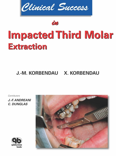 Clinical Success in Impacted Third Molar Extraction -  Jean-Marie Korbendau,  Xavier Korbendau