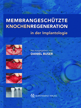 Membrangeschützte Knochenregeneration in der Implantologie - Daniel Buser