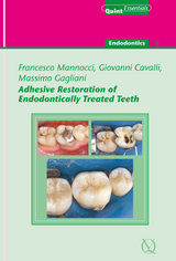 Adhesive Restoration of Endodontically Treated Teeth - Francesco Mannocci, Massimo Gagliani, Giovanni Cavalli