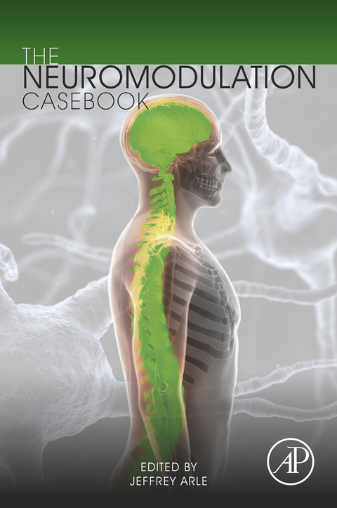 Neuromodulation Casebook - 