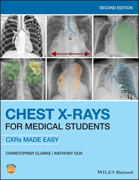 Chest X-Rays for Medical Students -  Christopher Clarke,  Anthony Dux