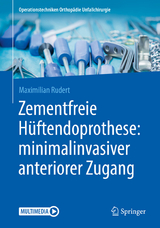 Zementfreie Hüftendoprothese: minimalinvasiver anteriorer Zugang - Maximilian Rudert