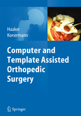 Computer and Template Assisted Orthopedic Surgery - 