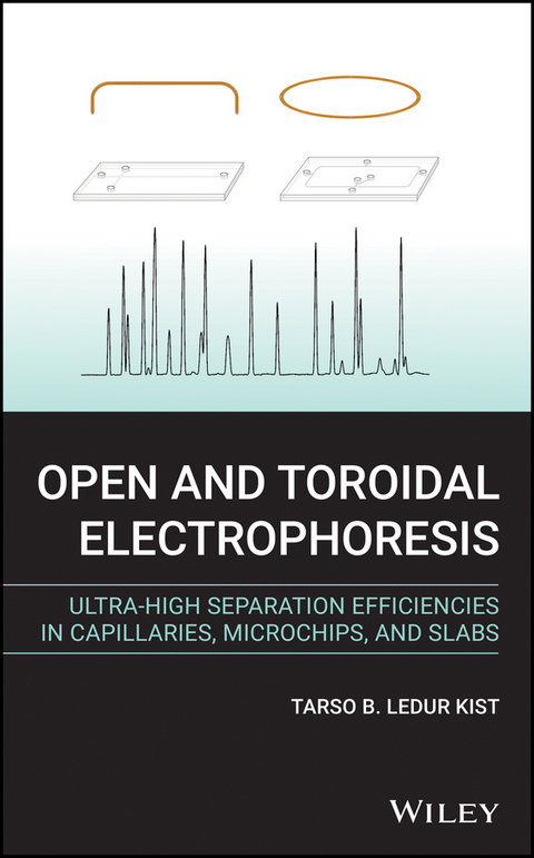 Open and Toroidal Electrophoresis -  Tarso B. Ledur Kist